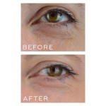 RETINAL 10 cream/serum Кристална форма 0,1% ретиналдехид нощен крем/серум RETINAL 10 cream/serum Кристална форма 0,1% ретиналдехид нощен крем/серум
